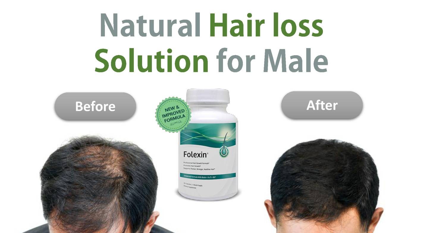 Folexin Hair Loss Solution For Men Pdf Docdroid