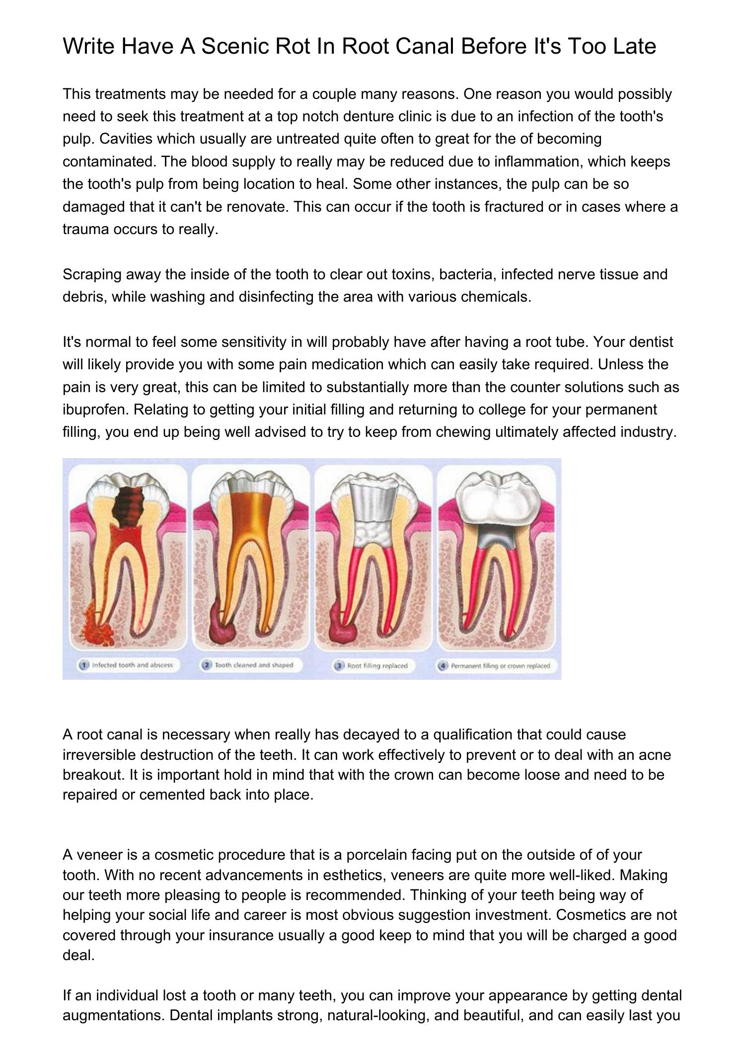 Teeth Whitening Works For Melepwm.pdf.pdf DocDroid