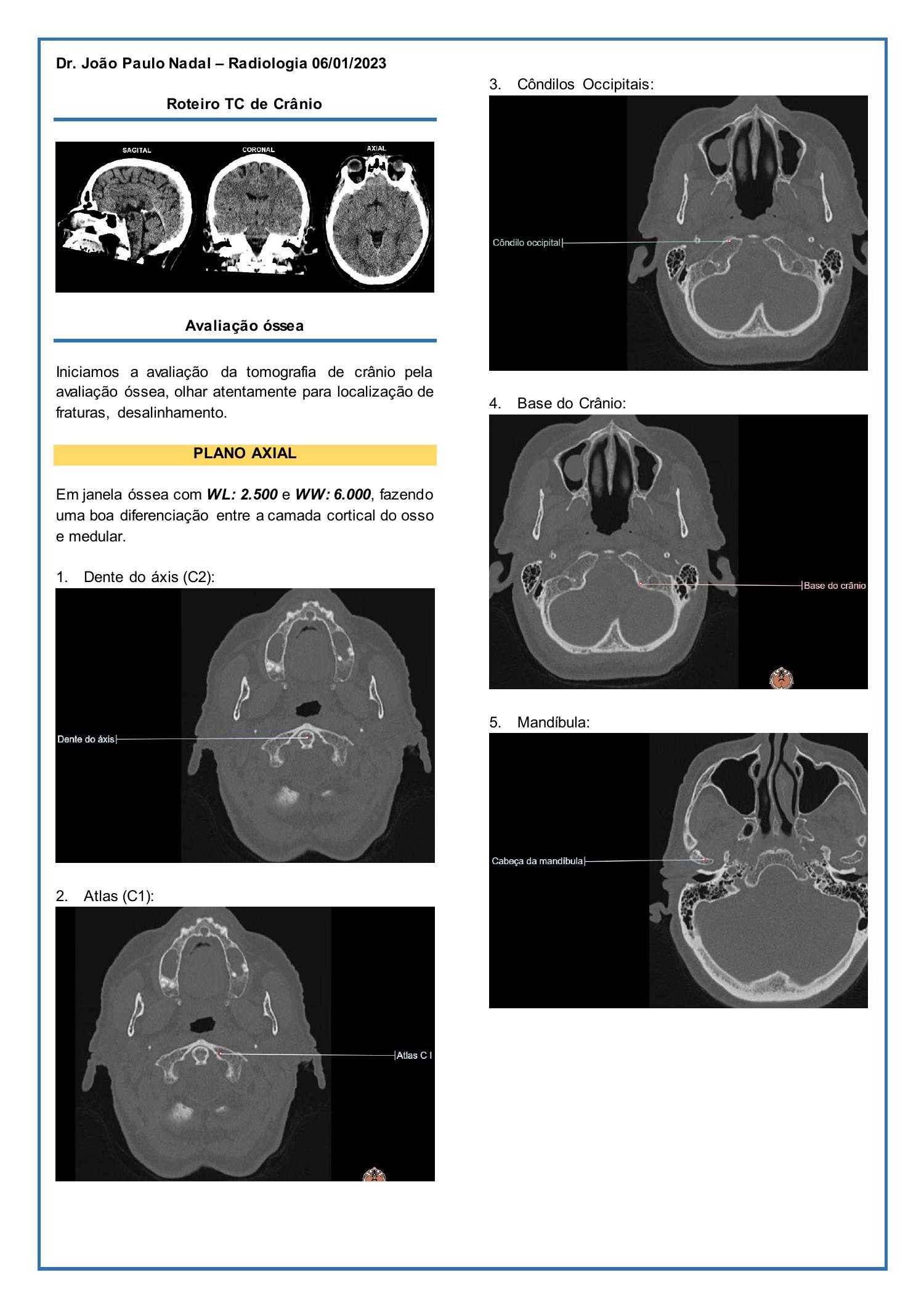 Roteiro Tc De Crânio Pdf Docdroid