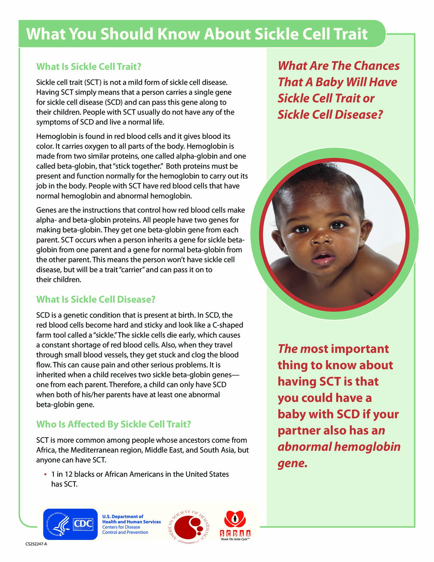 Sickle Cell Disease > Fact Sheets > Yale Medicine – FDEU