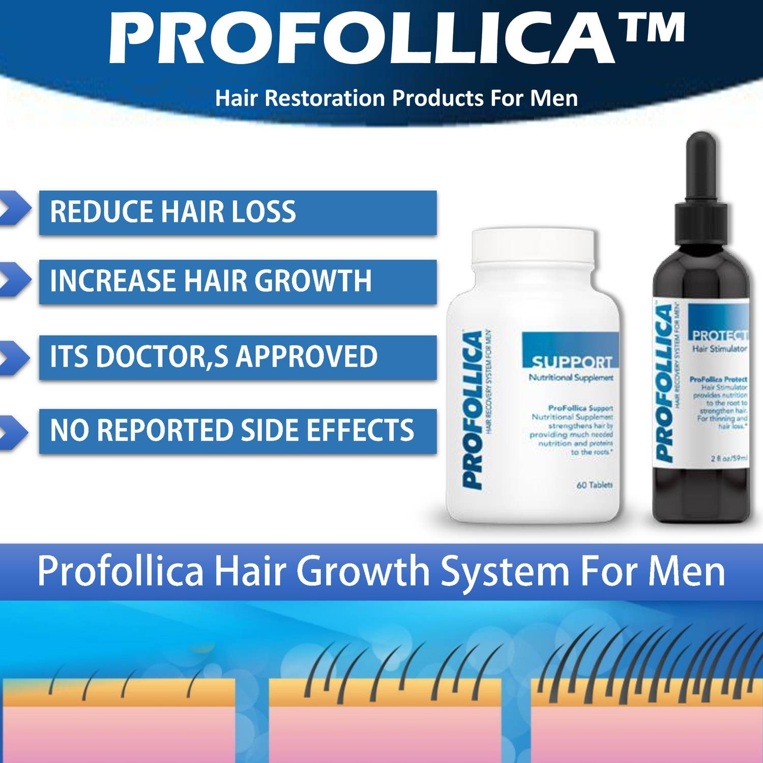 Profollica Hair Loss Treatment.pdf DocDroid