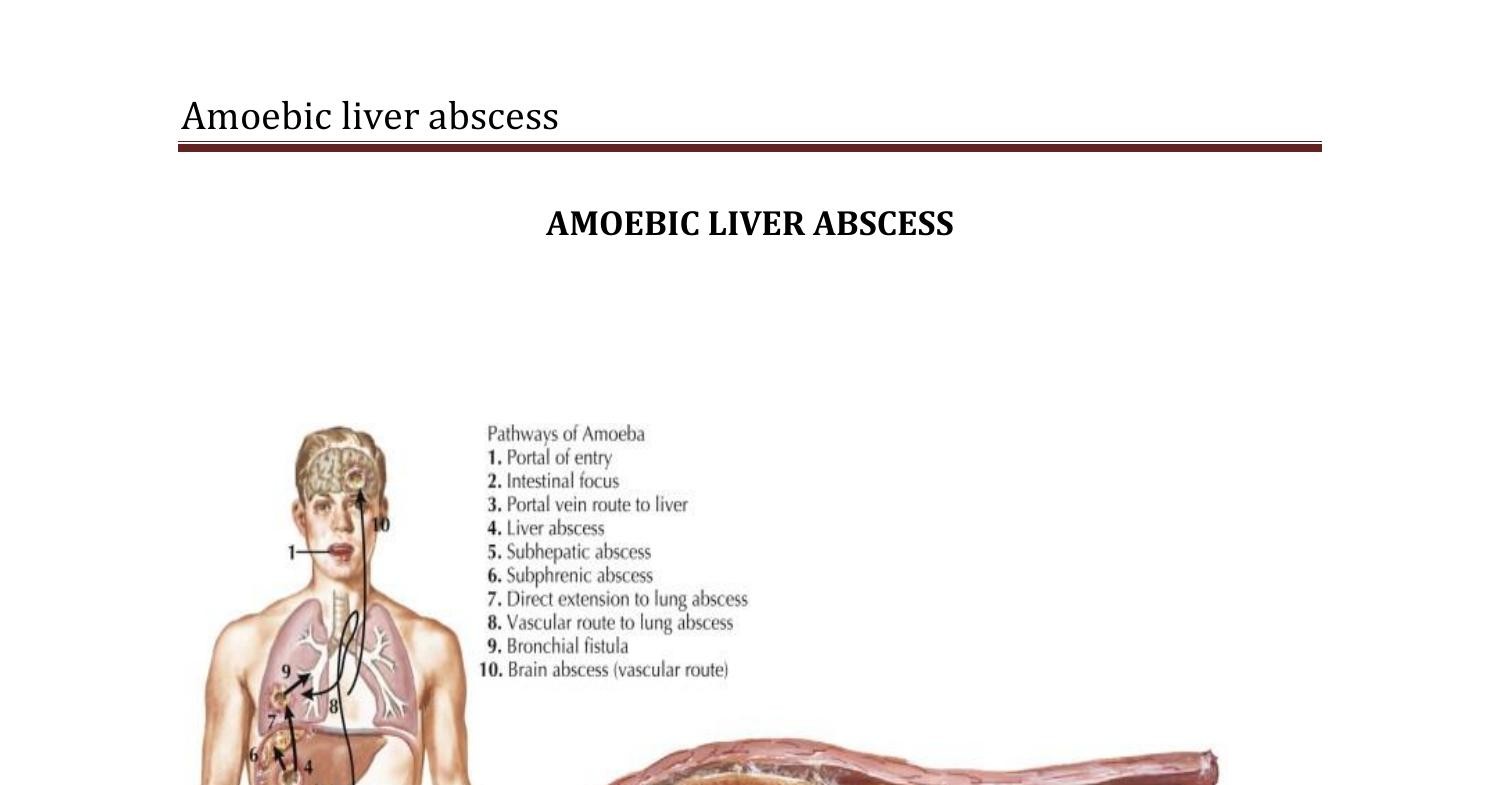 AMOERIC LIVER ABSCESS.doc DocDroid