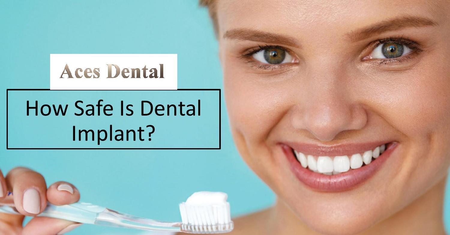 How Safe Is Dental Implant.pptx DocDroid