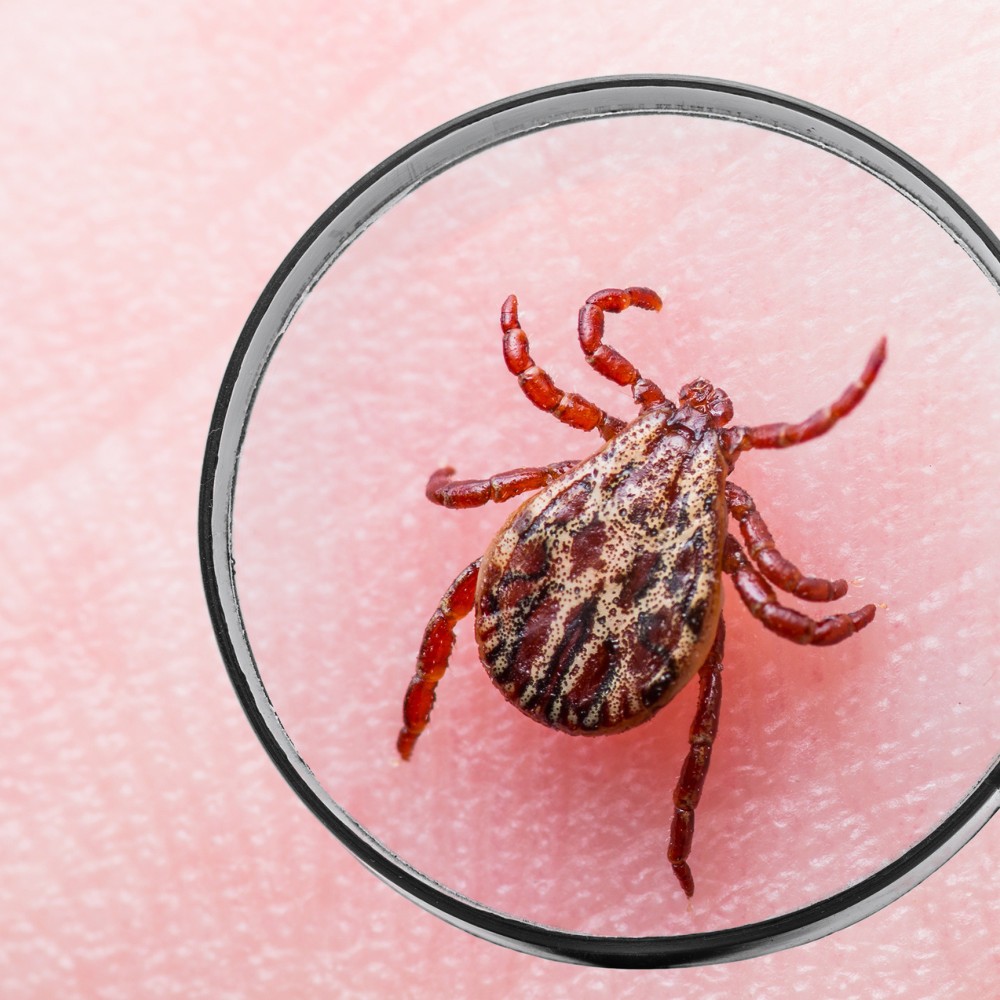 Faszinierend Anzeichen Einer Borreliose Bilder
