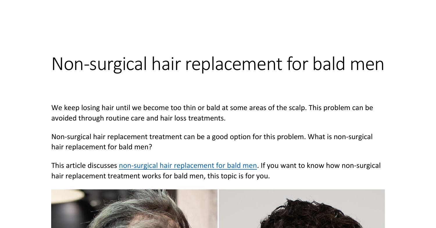 Non Surgical hair replacement for bald  | DocDroid